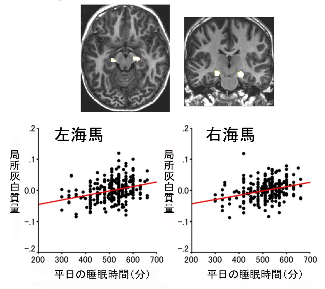 記憶にかかわる脳の海馬は 睡眠時間が長い子供のほうが より大きい 瀧靖之教授の研究が第３５回日本神経科学大会 記者会見で取り上げられました 東北メディカル メガバンク機構